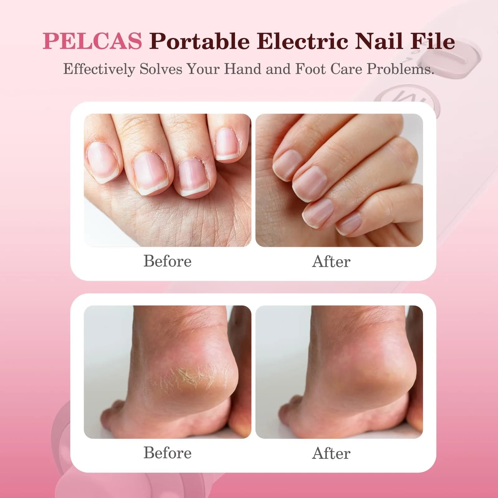 PELCAS Cordless Electric Nail Drill with LED Light - Portable Manicure & Pedicure Kit (White, 5-Hour Battery) - view 2