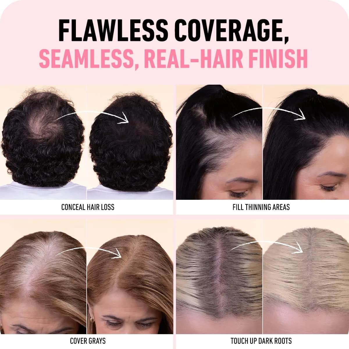 Boldify Hairline Powder Sample Kit, Light + Medium Browns | Instant Root Coverage for Thinning Hair - view 6