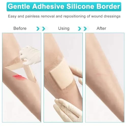 CAKRNPS Silicone Foam Dressing 4" x 4" | Waterproof, Absorbent, Self Adhesive for Wounds thumbnail 8