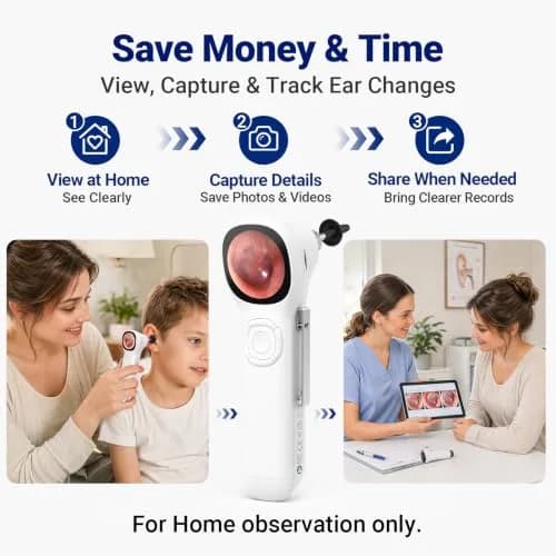 ScopeAround Otoscope with Light | HD Screen, No App Needed, Family Ear Camera thumbnail 6