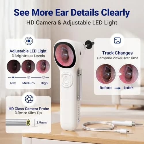 ScopeAround Otoscope with Light | HD Screen, No App Needed, Family Ear Camera thumbnail 3