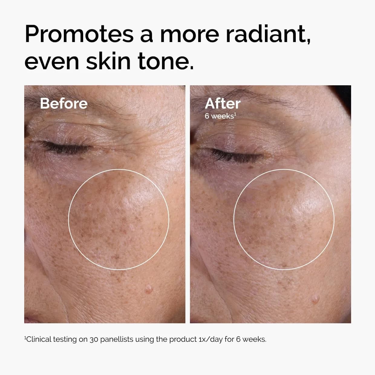 The Ordinary Glycolic Acid 7% Exfoliating Toner 480ml (16.2 Fl Oz) | Brightens & Smooths Skin Tone thumbnail 2