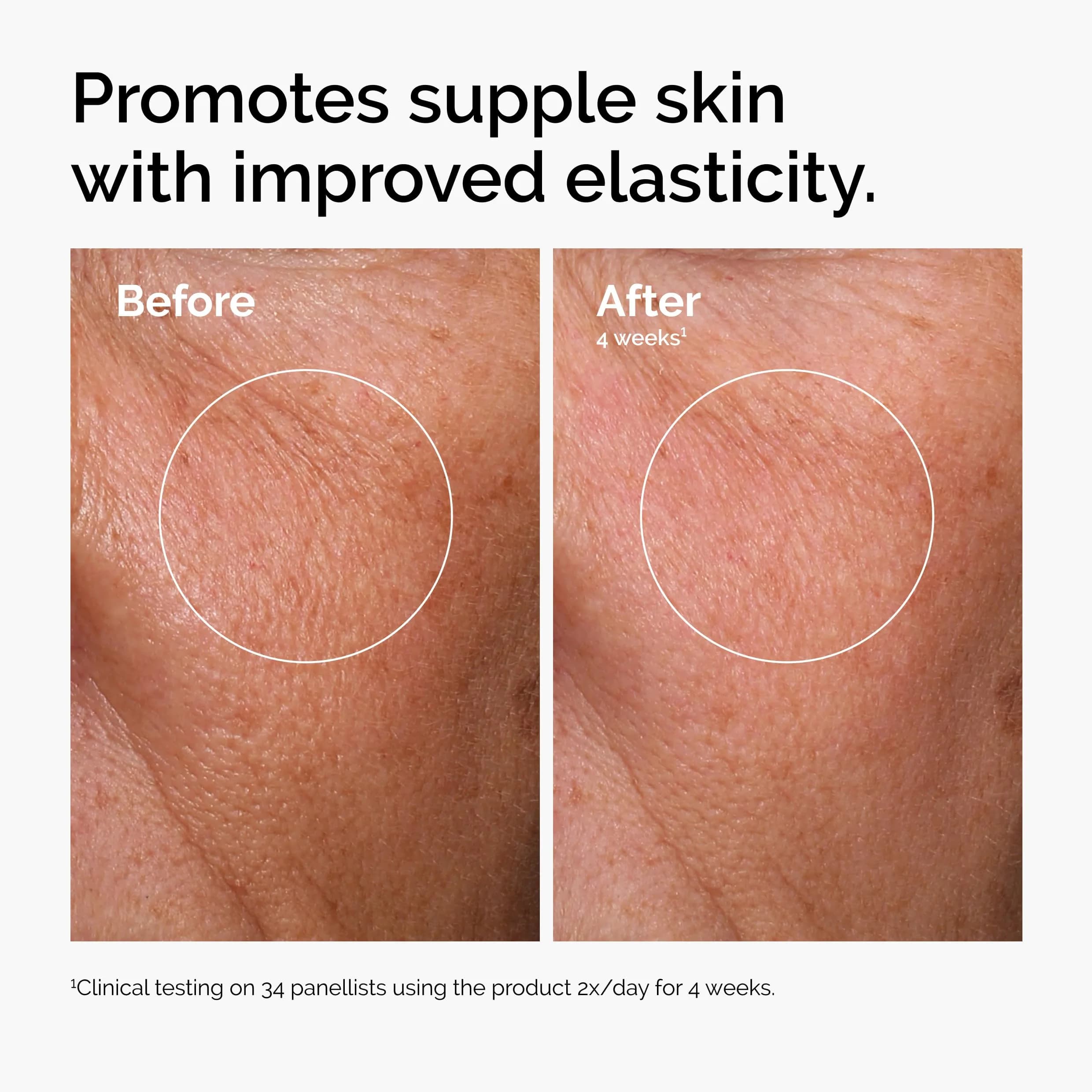 The Ordinary Hyaluronic Acid 2% + B5 Serum with Ceramides, Multi-Depth Hydration, 30ml (1 Fl Oz) - Pack of 2 thumbnail 2