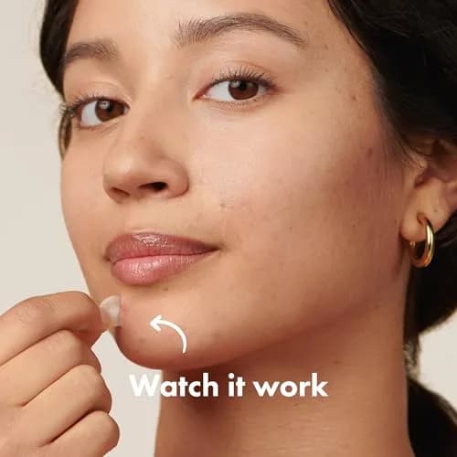 Mighty Patch Original Pimple Patches, 75 Ct | Clinically Tested & Drug-Free Overnight Acne Treatment thumbnail 3