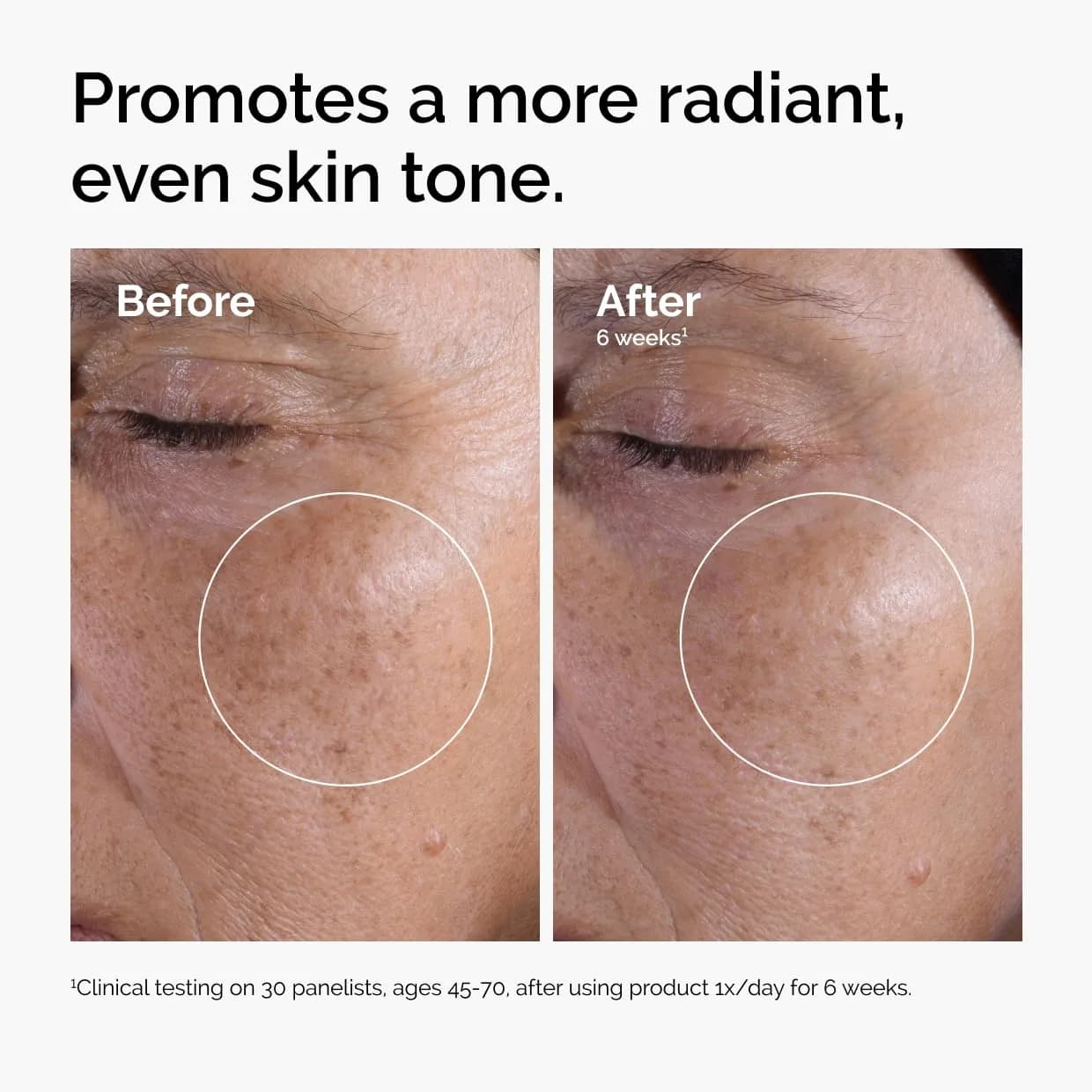 The Ordinary Glycolic Acid 7% Toning Solution 240ml (8.1oz) | Exfoliating & Smoothing Daily Toner - view 2