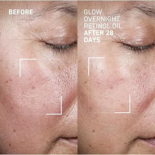 Dr. Brandt Bright This Way Glow Overnight Retinol Oil - 2 x 30ml | Nourishing Night Skin Renewal thumbnail 2