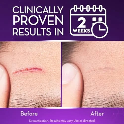 Cicatricure Advanced Scar Gel 2 oz | Proven Results in 2 Weeks for Face & Body thumbnail 3