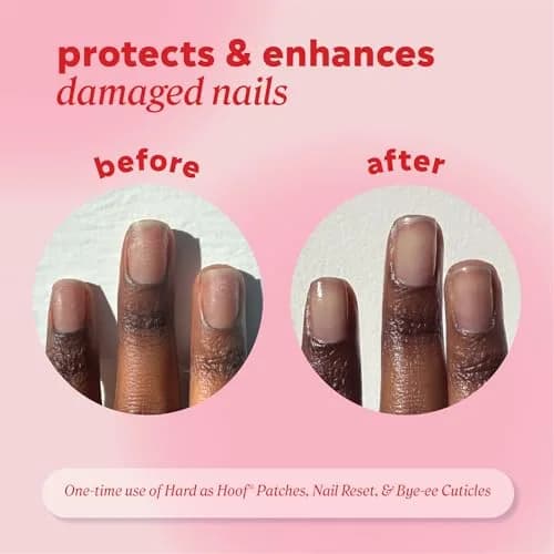 Onyx Professional Hard as Hoof Nail Repair Patches 20 Count | Overnight Nail & Cuticle Strengthening Treatment thumbnail 4