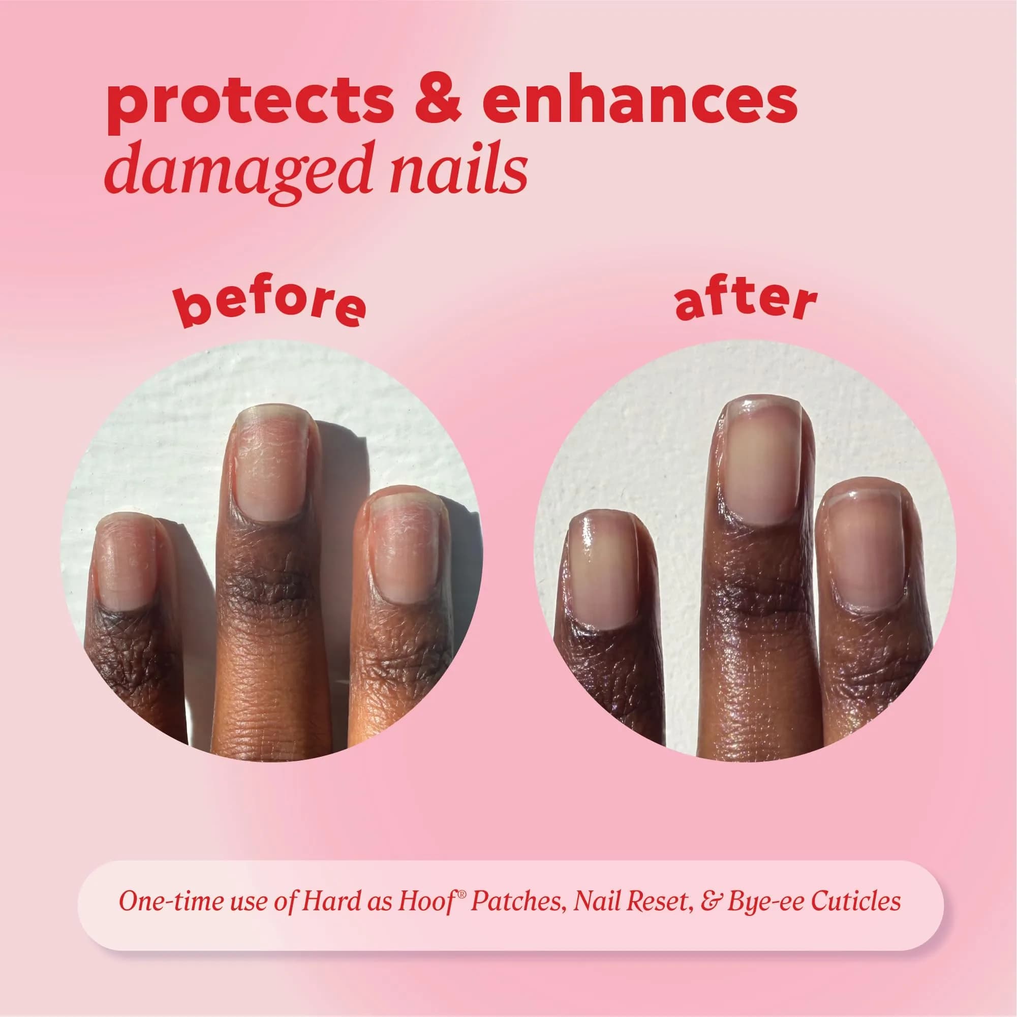 Onyx Professional Hard as Hoof Nail Repair Patches - 20 Count | Stops Splits, Chips, Cracks & Promotes Nail Growth - view 4