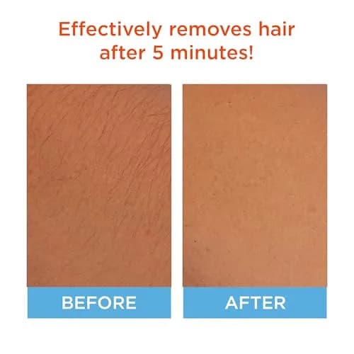 Sally Hansen Cream Hair Remover for Face 50ml (1.7 Fl Oz) | Vegan Formula for Smooth Skin thumbnail 2