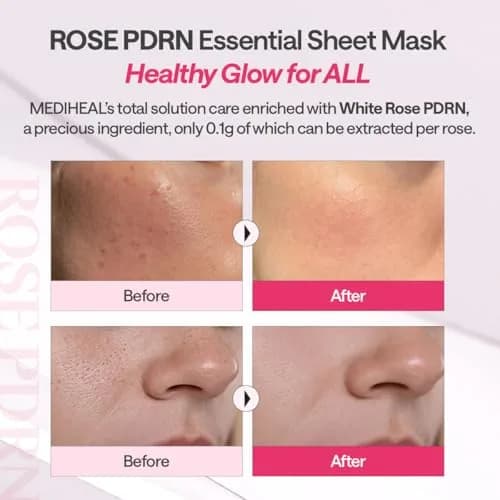 MEDIHEAL Rose PDRN Essential Face Sheet Mask 10ea | Korean Skincare for Healthy Glow thumbnail 5