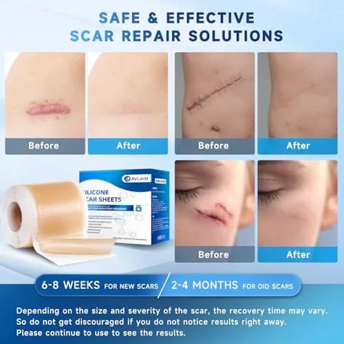 Rvlaim Silicone Scar Sheets 1.8” x 157” Roll | Medical-Grade, Reusable & Waterproof thumbnail 4