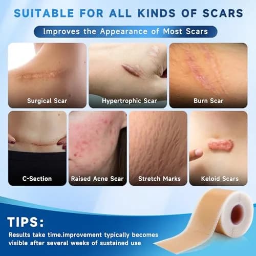 Rvlaim Silicone Scar Sheets for Surgical & Burn Scars, 3M, 1.6” x 120” Roll | Medical-Grade, Reusable & Hypoallergenic thumbnail 3