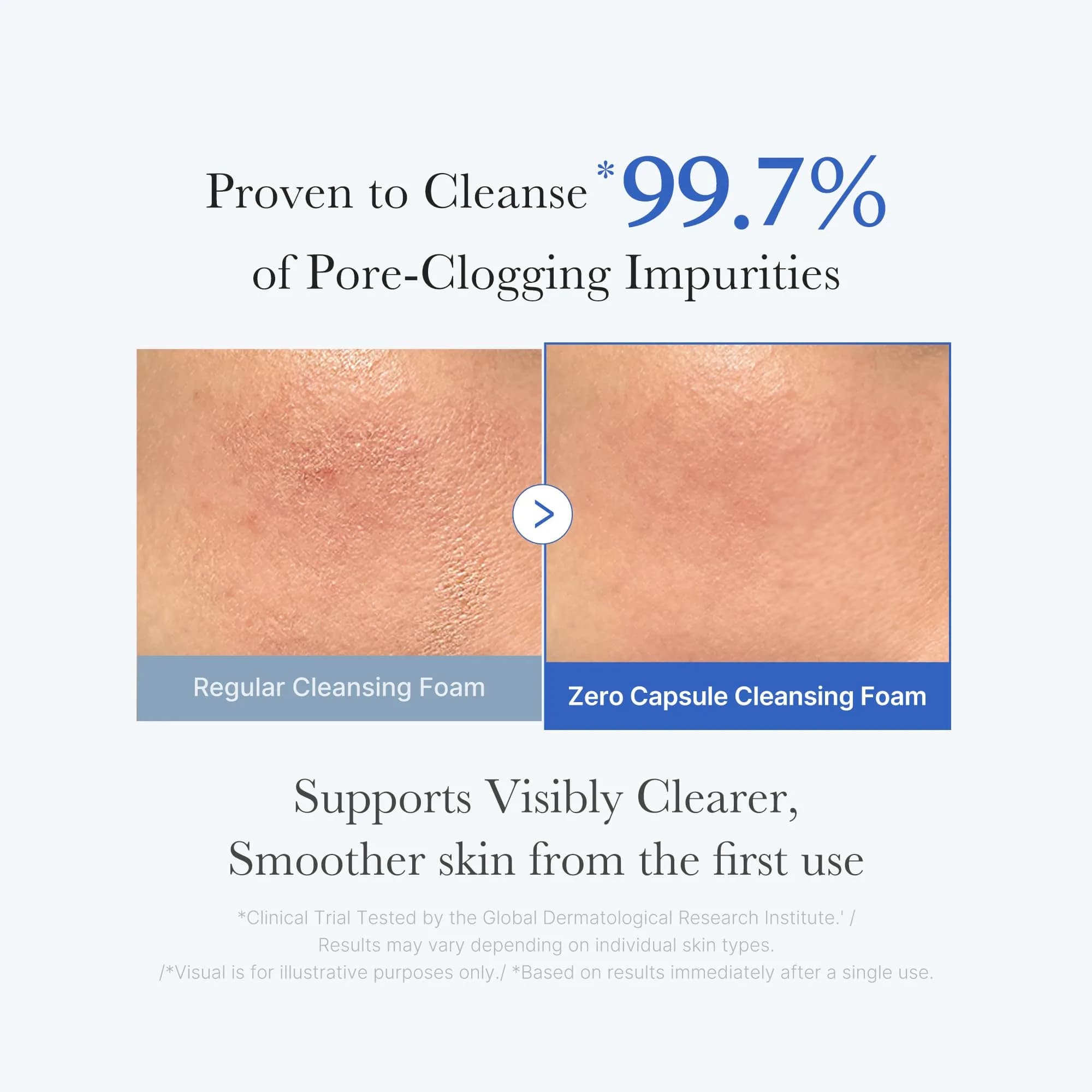 medicube Zero Pore Capsule Cleansing Foam AHA BHA PHA 120g (4.23 oz) | Deep Cleansing for Texture & Pore Care - view 3