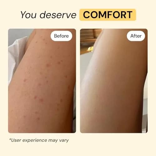 MyMagicHealer Thyme & Tea Tree Flare Care Salve 29.57 ml (1 oz) | Soothes Breakout-Prone Skin, Ingrown Hair & Bumps thumbnail 4