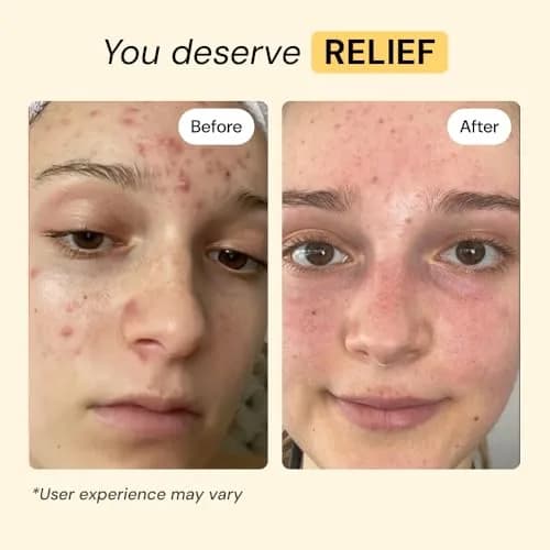 MyMagicHealer Thyme & Tea Tree Flare Care Salve 29.57 ml (1 oz) | Soothes Breakout-Prone Skin, Ingrown Hair & Bumps thumbnail 3