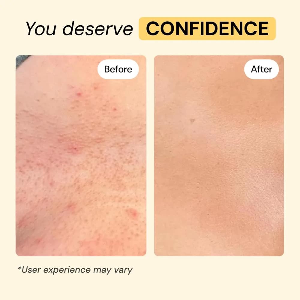 MyMagicHealer Universal Flare Care Drawing Salve 1 oz (28.35 g) | For Boils, Cysts & Irritated Skin - view 5