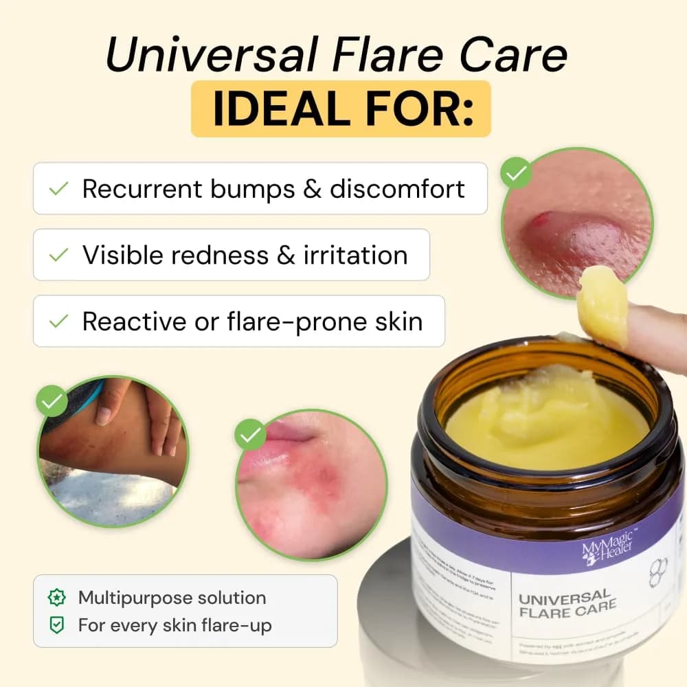 MyMagicHealer Universal Flare Care Drawing Salve 1 oz (28.35 g) | For Boils, Cysts & Irritated Skin - view 2
