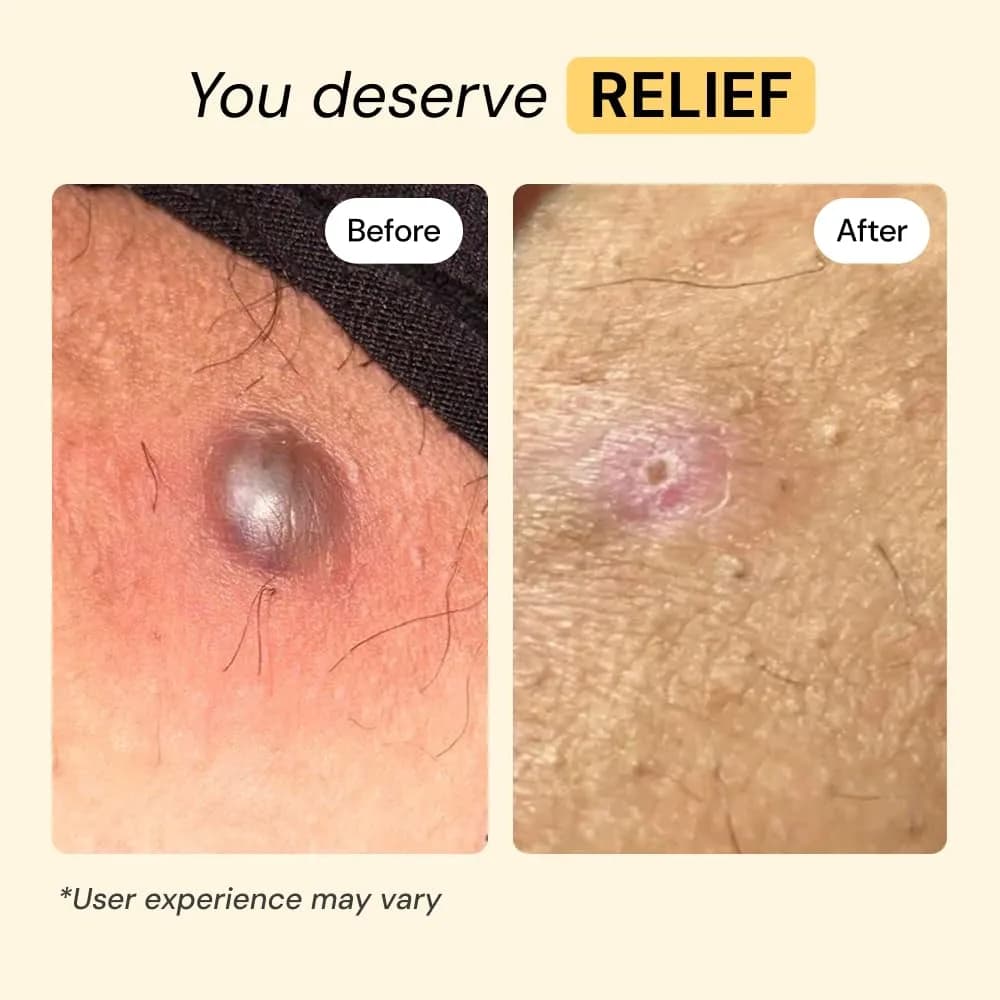 MyMagicHealer Universal Flare Care Drawing Salve 1 oz (28.35 g) | For Boils, Cysts & Irritated Skin - view 3