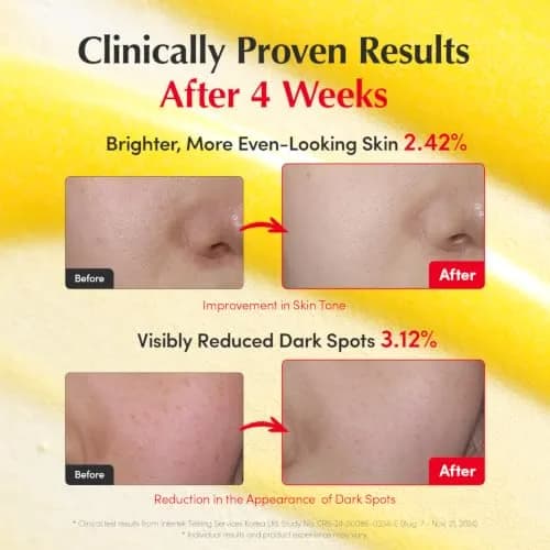 EQQUALBERRY Vitamin Illuminating Serum Double Pack | 60ml (2.02 Fl Oz) | Brightens Dark Spots & Uneven Tone thumbnail 3