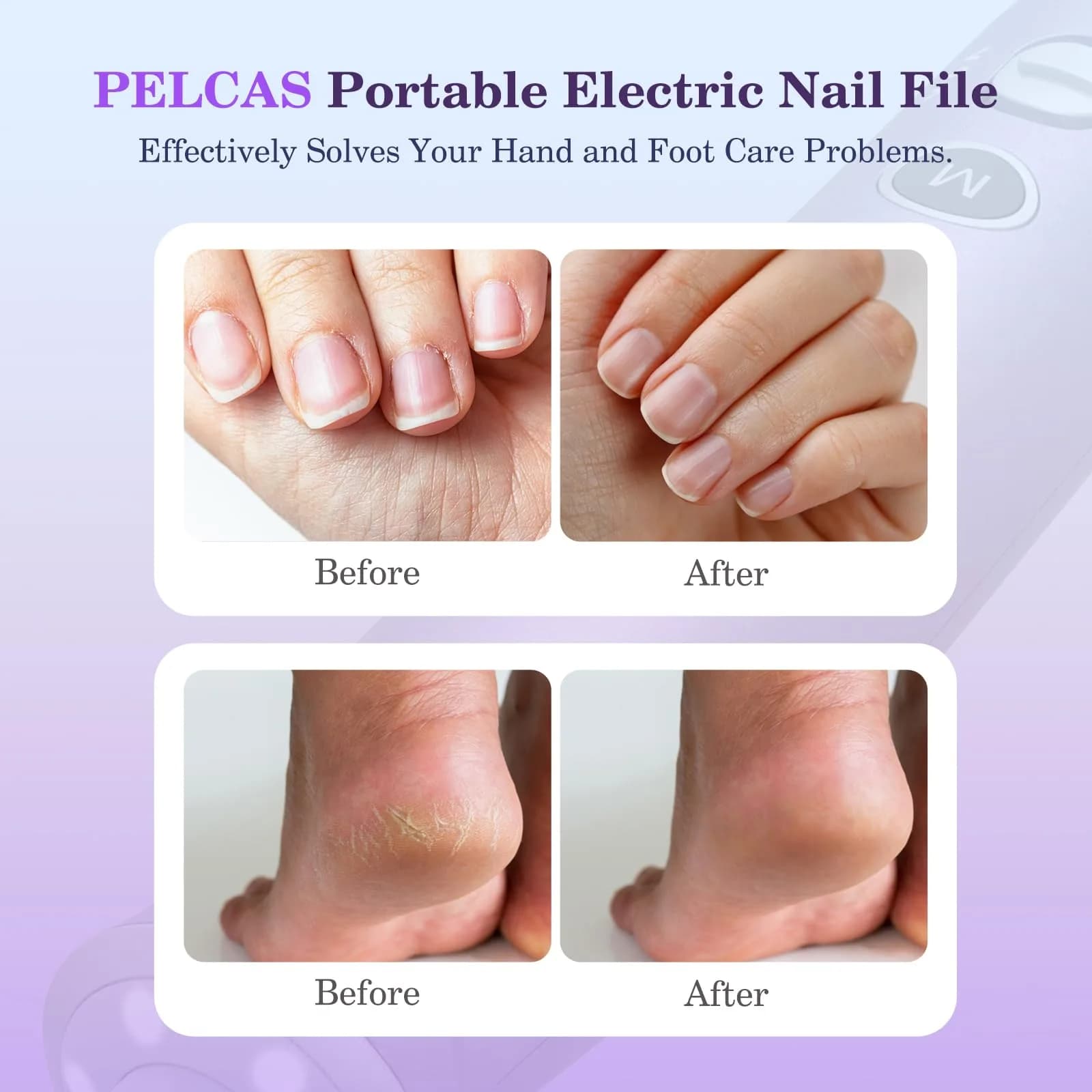 PELCAS Cordless Electric Nail Drill with LED Light, 10 Speeds & LCD Screen, Portable Manicure & Pedicure Kit (Purple, 5-Hour Battery) - view 2