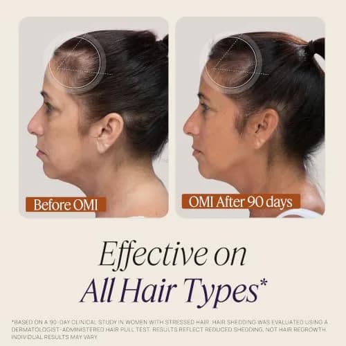 OMI Peptides for Hair Growth Gummies for Women 60 Gummies | Supports Thicker, Fuller Hair thumbnail 4