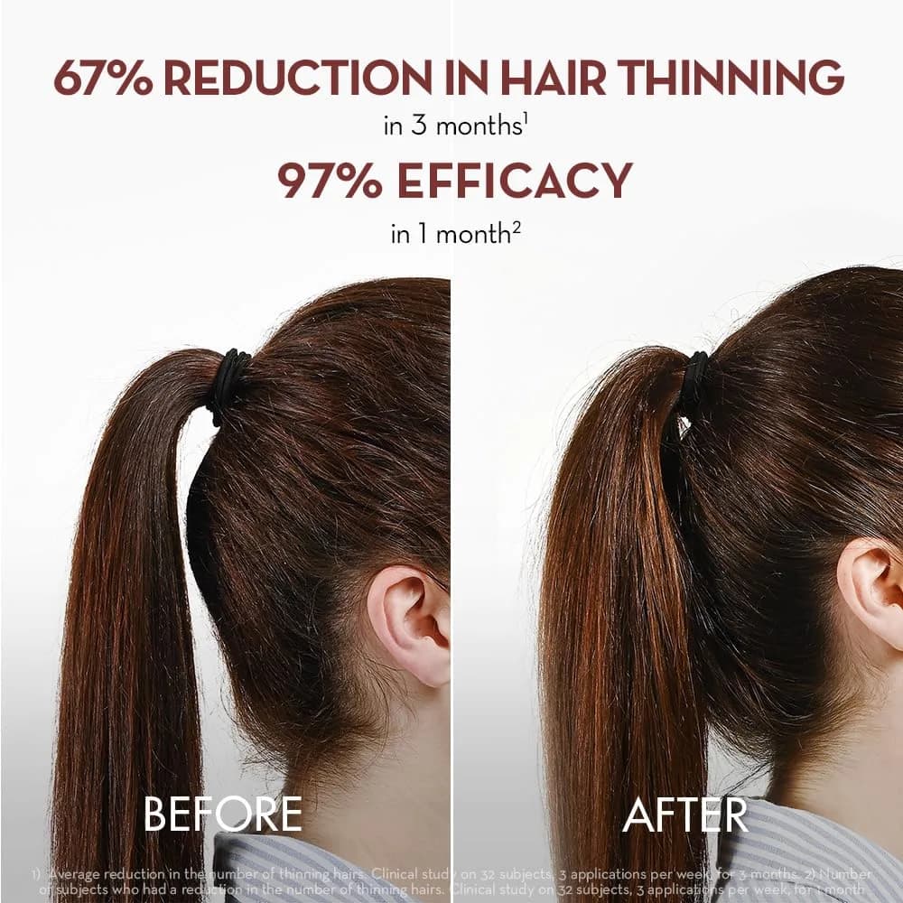Klorane Thickening Hair Serum with Quinine & Biotin 100ml (3.3 Fl Oz) | Clinically Proven Hair Thinning Treatment - view 3