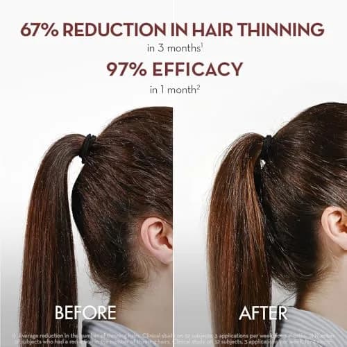 Klorane Thickening Hair Serum with Quinine & Biotin 100ml (3.3 Fl Oz) | Clinically Proven Hair Thinning Treatment thumbnail 3