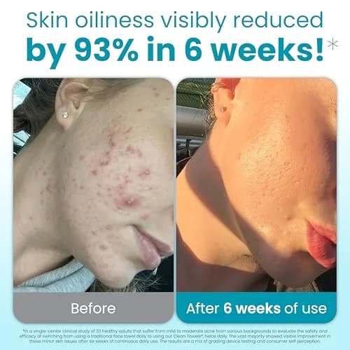 CLEAN SKIN CLUB Blemish Control Clean Towels XL, 50 Count (1 Pack) | Dermatologist-Approved for Oily Skin thumbnail 2