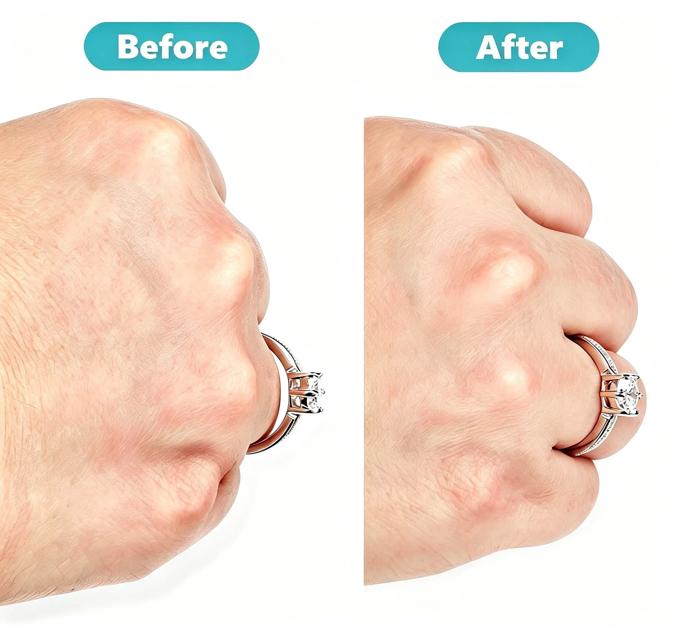 Feramox Invisible Ring Size Adjuster Set | 8 Sizes Fit 1mm-10mm Bands | Transparent TPU Material - view 5