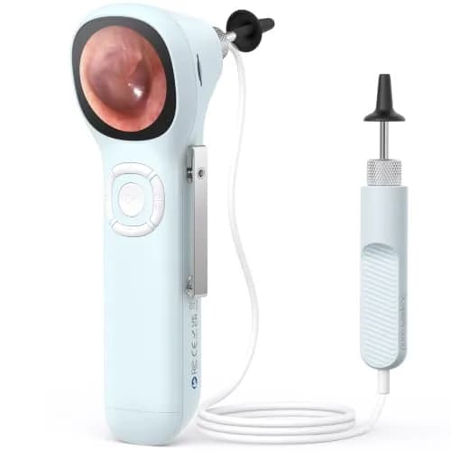 ScopeAround SA160 Otoscope with Light | HD Screen, No App Needed, Family Use thumbnail 1