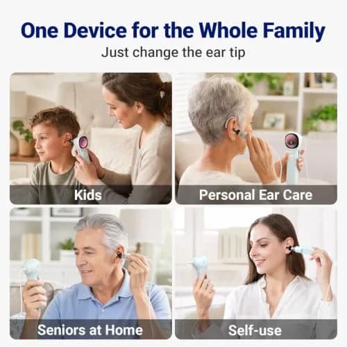 ScopeAround SA160 Otoscope with Light | HD Screen, No App Needed, Family Use thumbnail 4