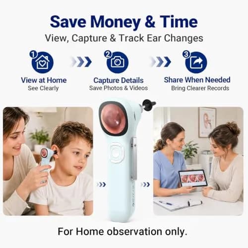 ScopeAround SA160 Otoscope with Light | HD Screen, No App Needed, Family Use thumbnail 6