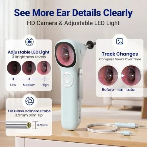 ScopeAround SA160 Otoscope with Light | HD Screen, No App Needed, Family Use thumbnail 3