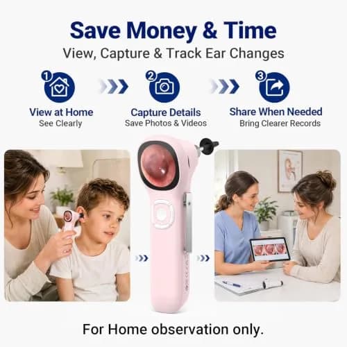 ScopeAround Otoscope with Light No App Needed HD Screen Family Use thumbnail 6