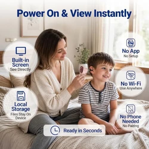 ScopeAround Otoscope with Light No App Needed HD Screen Family Use thumbnail 2