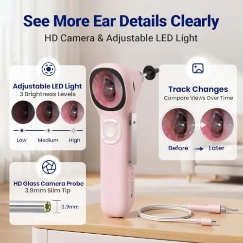 ScopeAround Otoscope with Light No App Needed HD Screen Family Use thumbnail 3