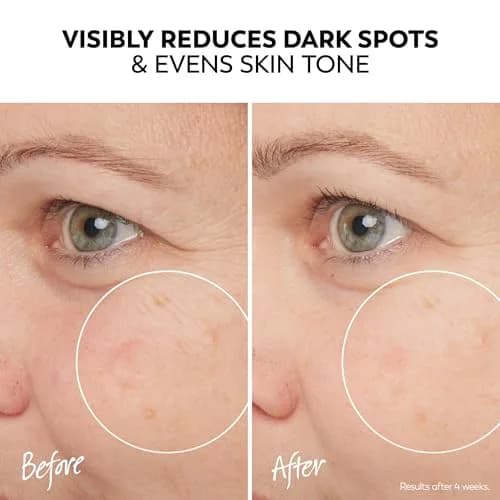 Olay Pro-X Dermatological Serum 1.3 oz | Brighten & Even Skin Tone thumbnail 4