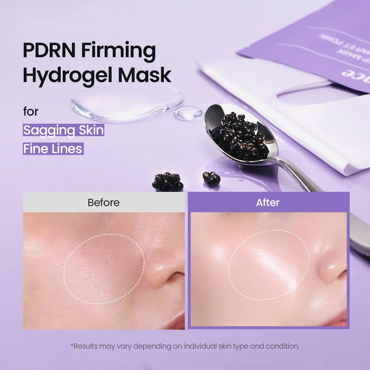 BIODANCE Rejuvenating Caviar PDRN Real Deep Mask Pack (4 x 34g / 1.19oz) | Overnight Hydrogel Skin Recovery - view 3