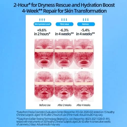 Yilian Hydrating Face Masks with 5 Hyaluronic Acids & Ceramides | Deep Moisture & Barrier Repair for Sensitive Skin thumbnail 3