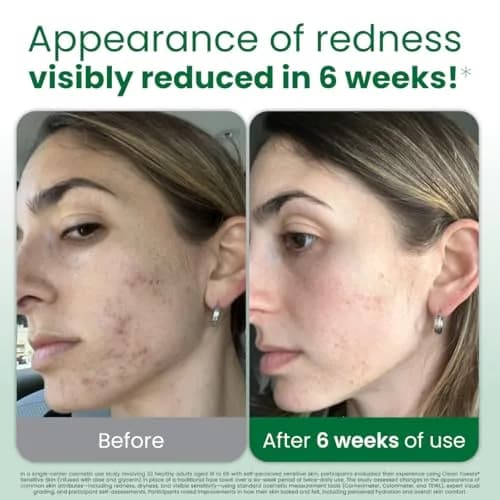 CLEAN SKIN CLUB Sensitive Skin Clean Towels XL, 50 Count | Dermatologist Approved Dry Wipes thumbnail 2