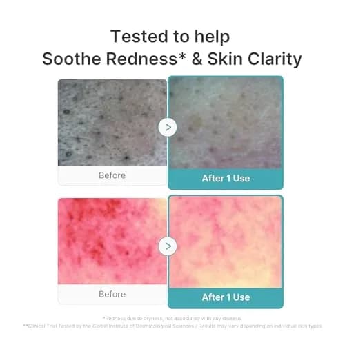 medicube Azelaic Acid Capsule Foam Cleanser 125ml (4.23 Fl Oz) | Soothing Daily Cleanser for Troubled Skin thumbnail 4