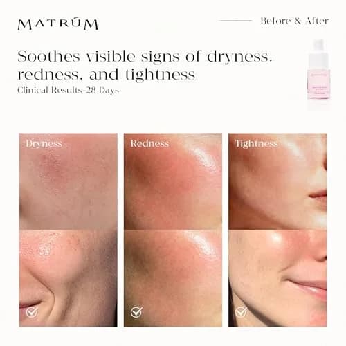 MATRÚM Mini Face Serum Duo | Travel Skincare Sets for All Skin Types with Soothing & Brightening (70-120 chars) thumbnail 5