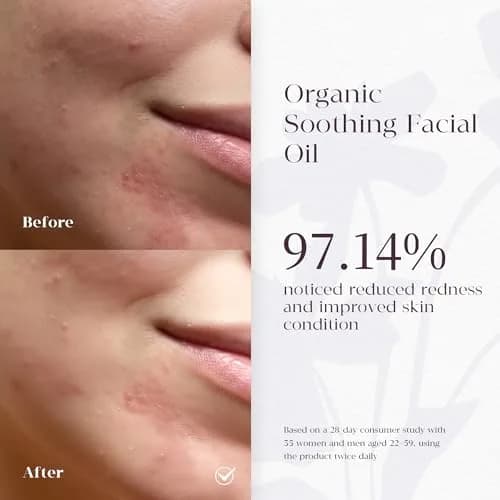 MATRÚM Organic Barrier Repair Face Serum – Brightening, Firming & Hydrating Serum for Dry & Sensitive Skin, Soothes Redness & Dryness, with Niacinamide, Vitamin E & Camelina Seed Oil thumbnail 5