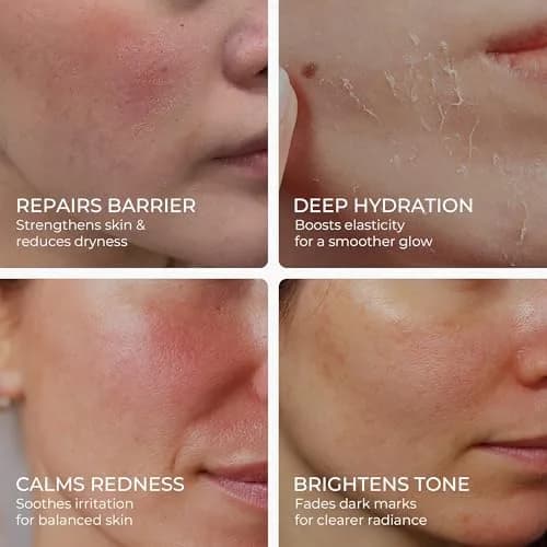 MATRÚM Organic Barrier Repair Face Serum – Brightening, Firming & Hydrating Serum for Dry & Sensitive Skin, Soothes Redness & Dryness, with Niacinamide, Vitamin E & Camelina Seed Oil thumbnail 3