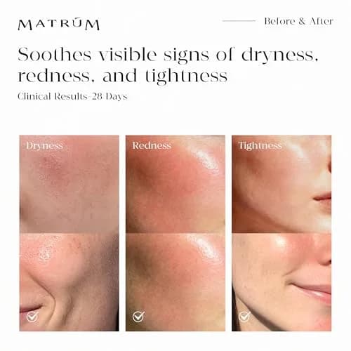 MATRÚM Mini Discovery & Travel Size Set - 4 x Mini Face Oil for Deep Repair & Radiance Boost & Firming thumbnail 8