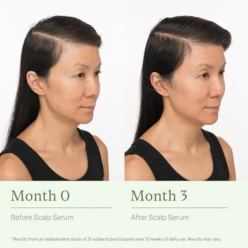 Divi Scalp Serum for Thinning Hair 30ml | Clinically Tested Nourishing Formula with Amino Acids & Rosemary Oil thumbnail 5