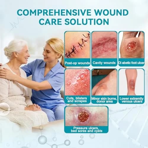 Dimora Calcium Alginate Wound Dressing 4'' x 4'' | Heavy Absorbent, Non-Stick, Sterile Gauze for Moderate to Heavy Exudate Wounds thumbnail 2