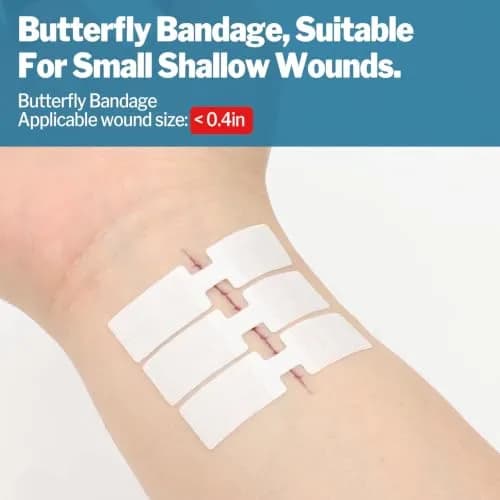 AZEN Emergency Wound Closure Strips 14 Pack (14 Count) | Hypoallergenic Butterfly Bandages for Laceration Repair Without Stitches thumbnail 5