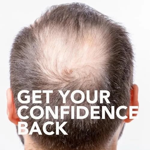 GoodSense Minoxidil Topical Solution USP 5% for Men, Extra Strength, 6 Fl Oz (Pack of 4) | Reactivates Hair Follicles thumbnail 6
